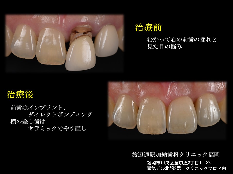 写真5
