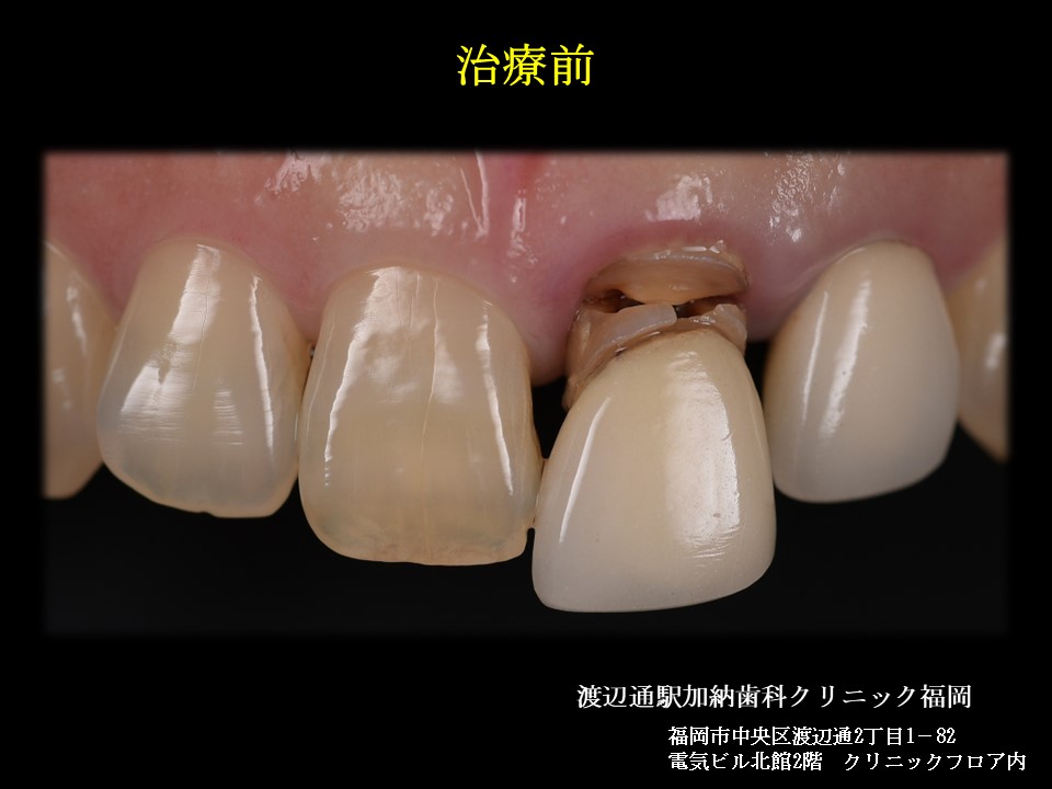 写真2