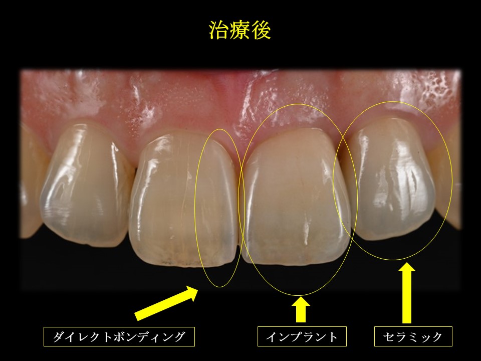 写真3