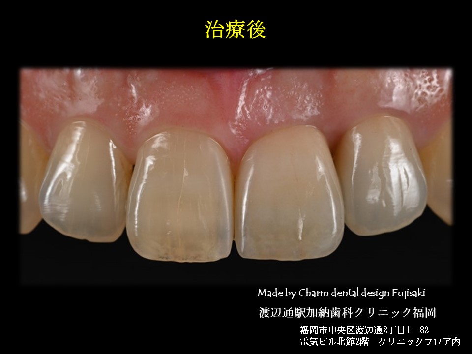 写真4