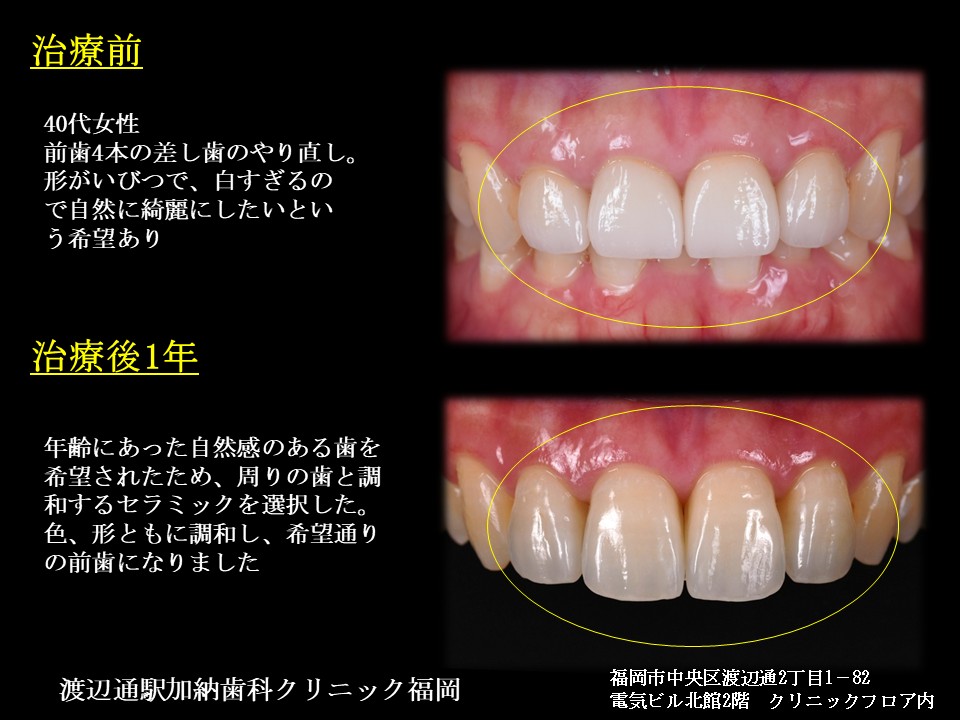 写真4