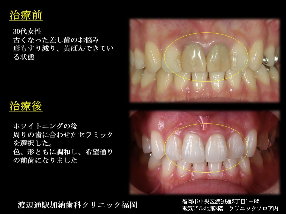 写真4
