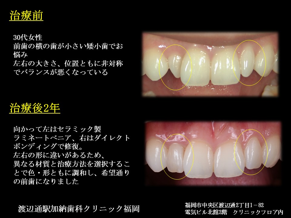 写真4