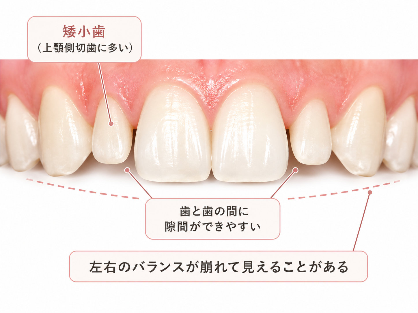 写真6