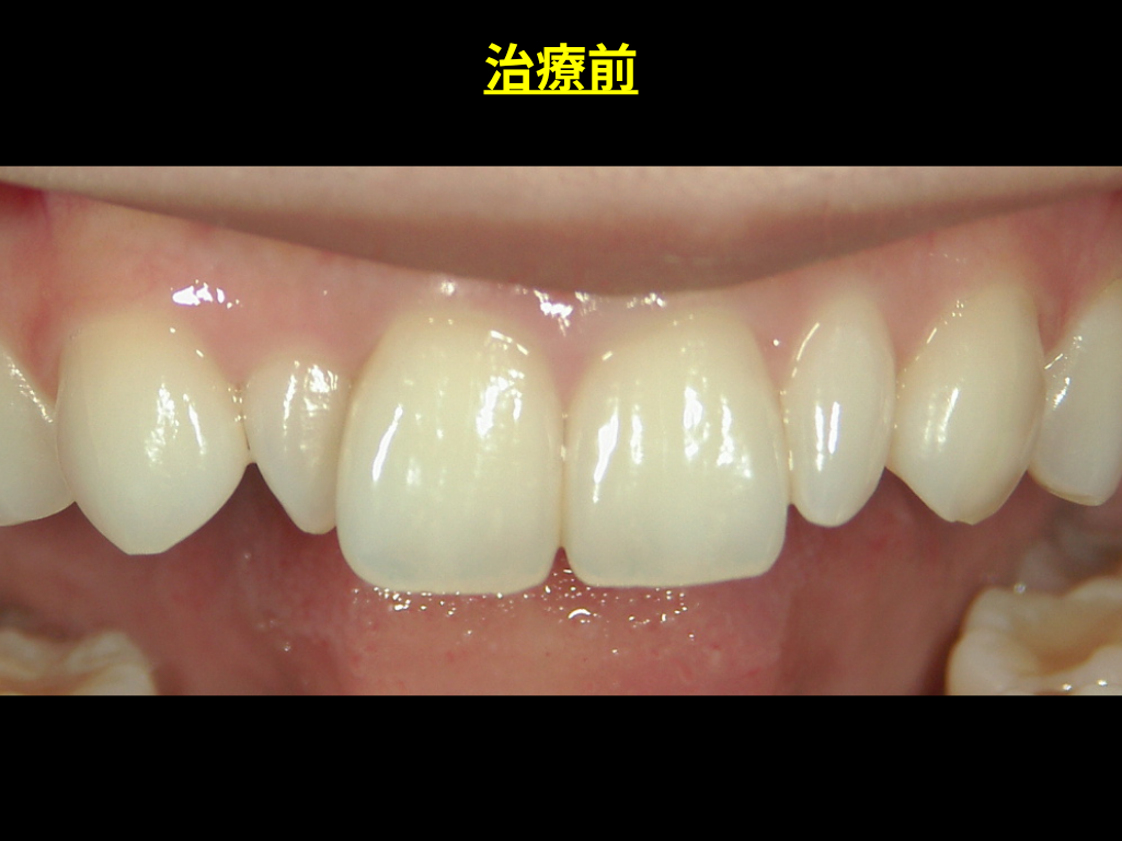 写真2