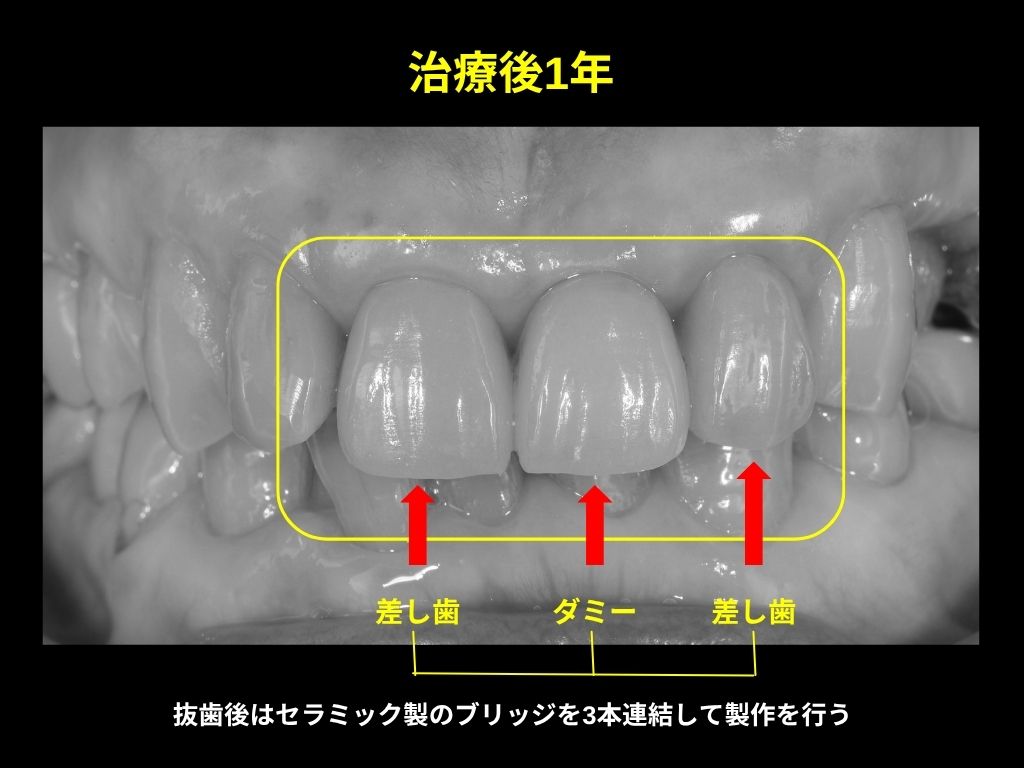 写真3