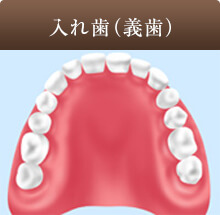 入れ歯（義歯）